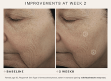 Load image into Gallery viewer, DrFreund Skincare SkinMedica TNS Advanced+Serum anti-aging serum, skincare, wrinkle and fine line corrector
